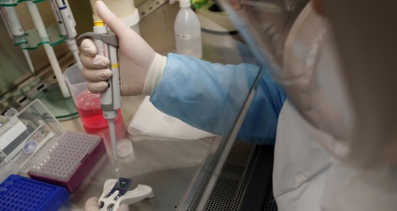 Nuevo avance contra coronavirus: Canadá también logra aislar patógeno
