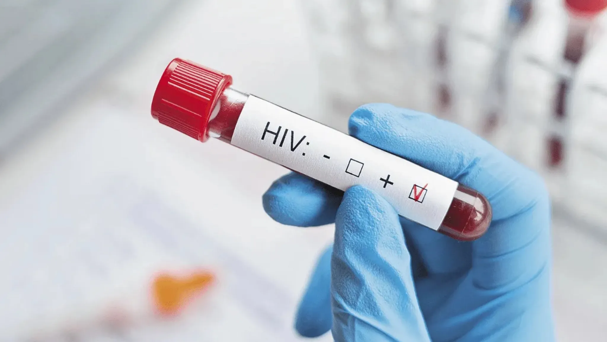 El VIH entre las personas en prisión a nivel mundial aumentó un 13%